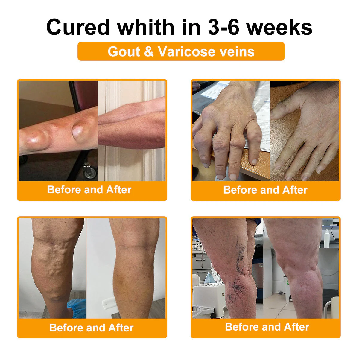 AQA™ Botulinum & Bee Essence Pain Relief Bone Healing Cream - Image 15