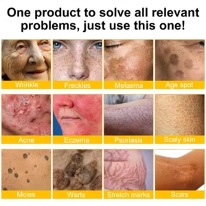 ODALIT® Bee Venom Skin Restoration Cream image ODALIT® Bee Venom Skin Restoration Cream