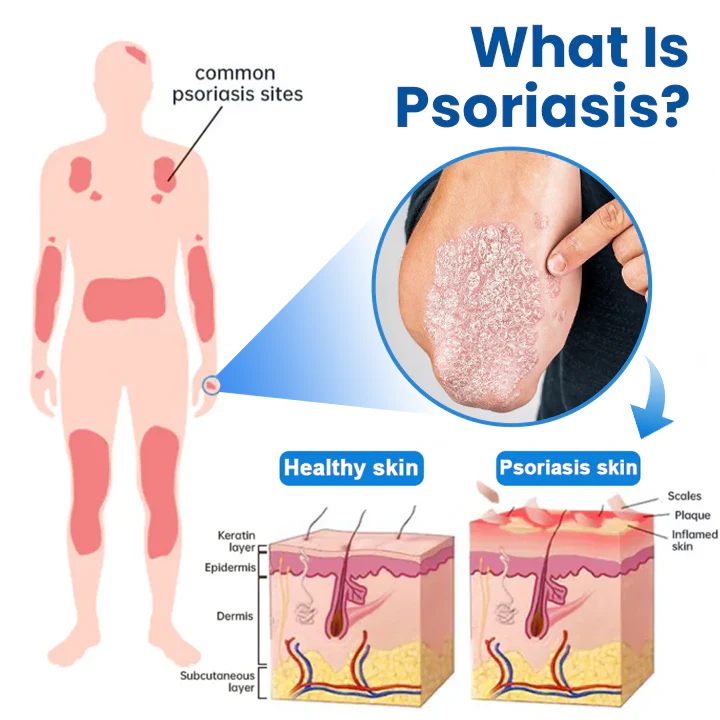 Timilk® Magnesium Herbal Treatment Spray image Timilk® Magnesium Herbal Treatment Spray