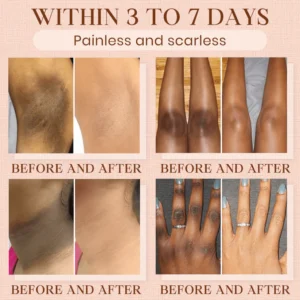 Luhaka® Purifying Exfoliating Gel for Acanthosis Nigricans