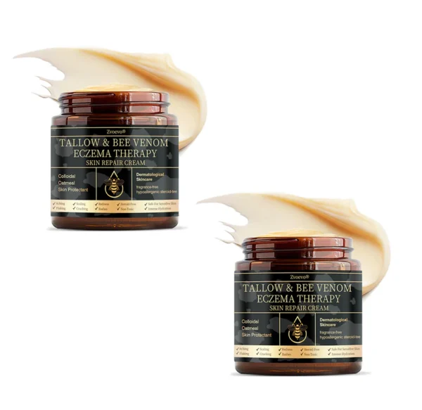 Zvoevo® Psoriasis & Eczema Relief Cream