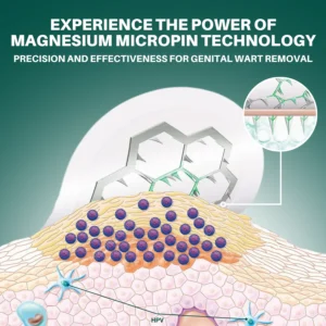 Fivfivgo® Magnesium MicroPin HPV Genital Wart Removal Patch