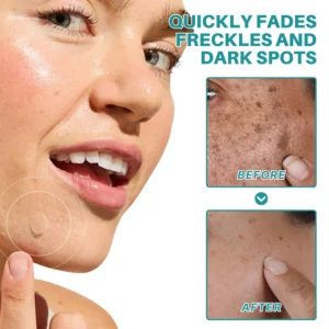Fivfivgo® Botanical Freckles & Spot Removal Patch image Fivfivgo® Botanical Freckles & Spot Removal Patch