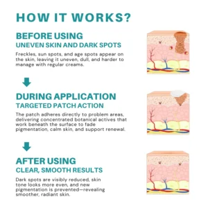 Fivfivgo® Botanical Freckles & Spot Removal Patch image Fivfivgo® Botanical Freckles & Spot Removal Patch