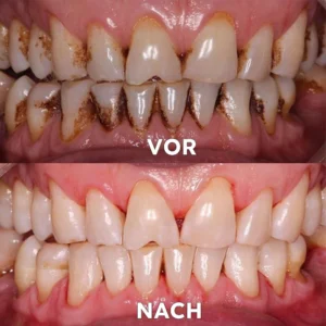 Seurico™ Gum Repair & Oral Health Powder