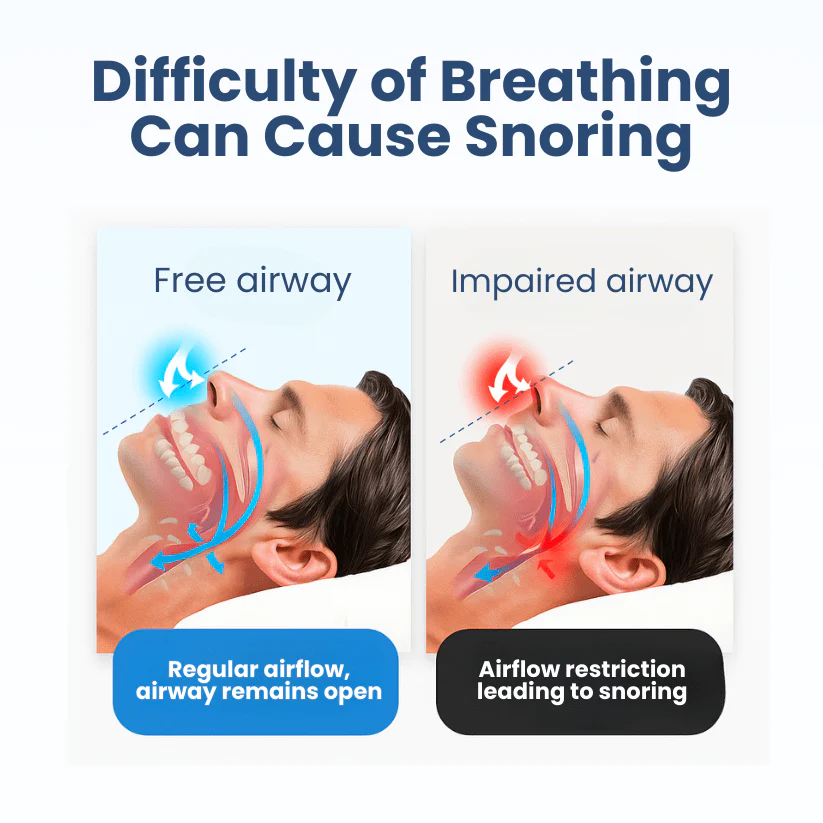 Lyyeto® Snoreless Nasal Breather