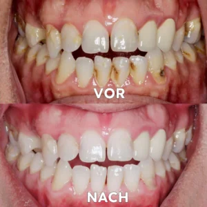 Seurico™ Gum Repair & Oral Health Powder