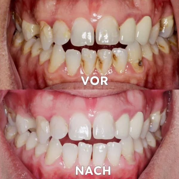 Seurico™ Gum Repair & Oral Health Powder