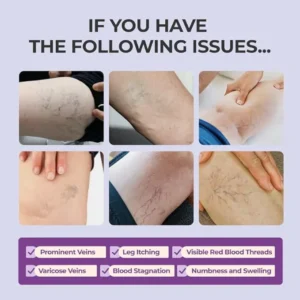 AQA™ Leg Relief Varicose Veins Cream