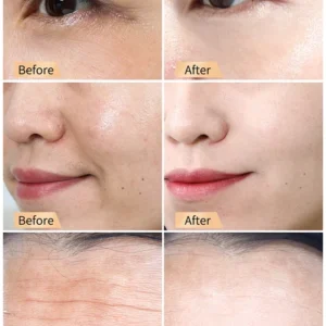 Snail Hydrating Anti-Wrinkle and Rejuvenating Cream