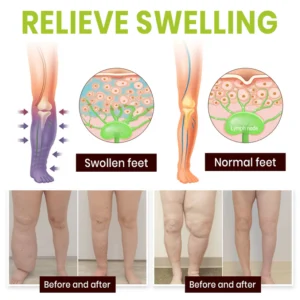 Lyyeto® Professional Leg Circulation Cream image Lyyeto® Professional Leg Circulation Cream