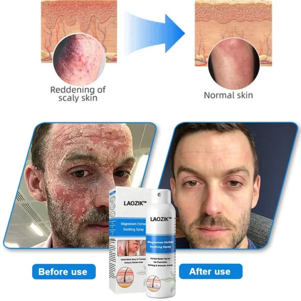 LAOZIK™ Magnesium Herbal Spray