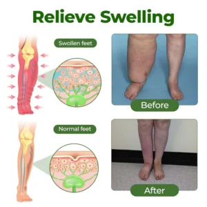 NovaRX® FluidEase Leg Therapy Edema Cream image NovaRX® FluidEase Leg Therapy Edema Cream