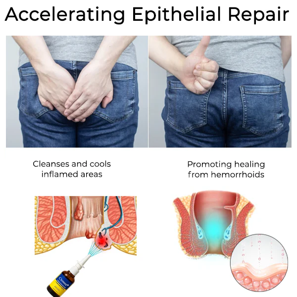 Cvreoz® Herbal Hemorrhoid Treatment Anal Spray Pro image Cvreoz® Herbal Hemorrhoid Treatment Anal Spray Pro