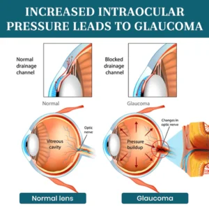 Lyyeto® OptiFusion Nano Eye Drops Serum image Lyyeto® OptiFusion Nano Eye Drops Serum