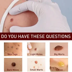 Fivfivgo™ WipeOff Tags & Mole Remover