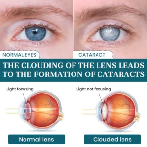 Lyyeto® OptiFusion Nano Eye Drops Serum image Lyyeto® OptiFusion Nano Eye Drops Serum