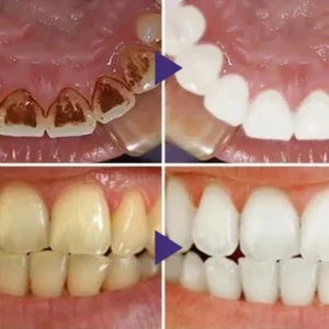 LOVILDS™ Gum Care Gel – Restore & Strengthen Your Gums image LOVILDS™ Gum Care Gel – Restore & Strengthen Your Gums