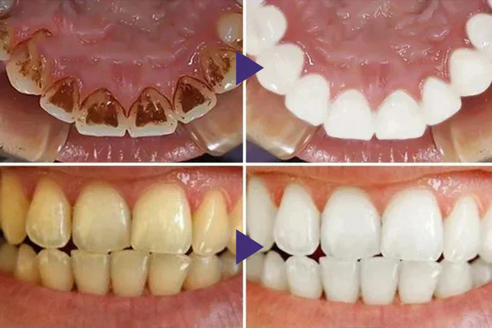 LOVILDS™ Gum Care Gel – Restore & Strengthen Your Gums image LOVILDS™ Gum Care Gel – Restore & Strengthen Your Gums