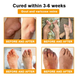 AQA™ Botulinum & Bee Essence Pain Relief Bone Healing Cream