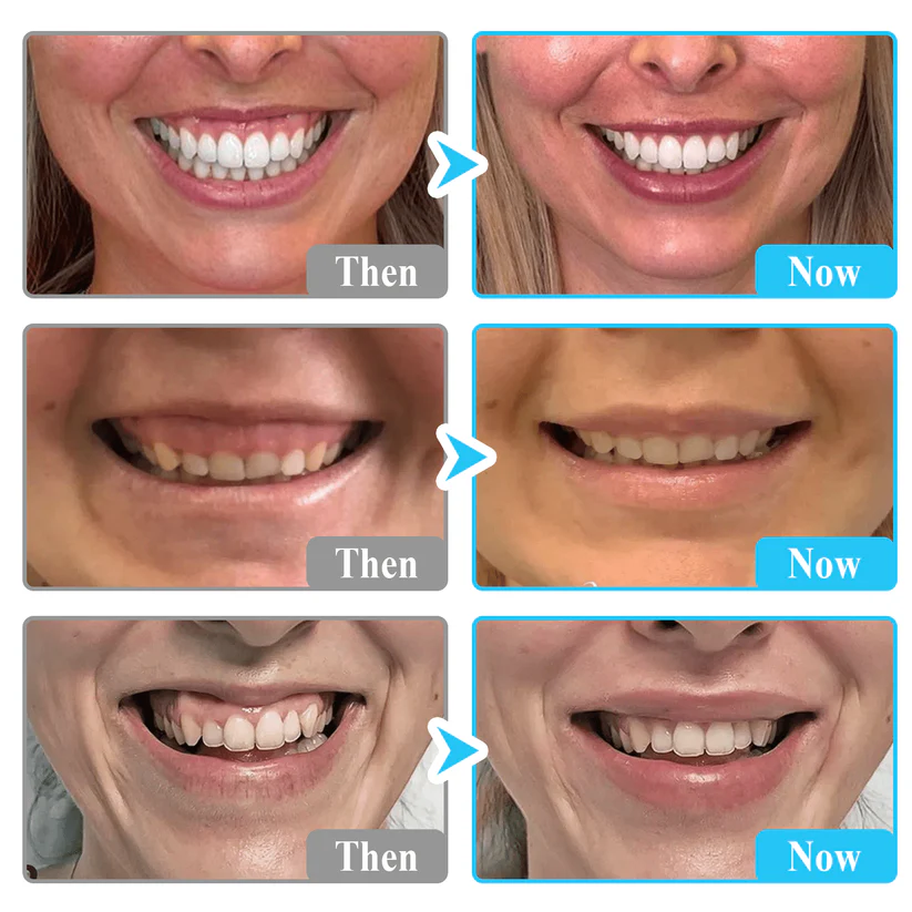 Lyyeto® Focussmile bee venom treatment powder for oral use image Lyyeto® Focussmile bee venom treatment powder for oral use