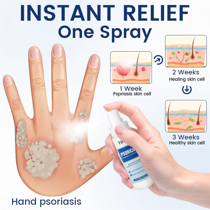 Timilk® PsoriCure Magnesium Herbal Spray image Timilk® PsoriCure Magnesium Herbal Spray