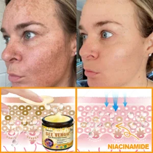 𝖠𝖯𝖪𝖠𝖯𝖪® 𝖡𝖾𝖾 𝗏𝖾𝗇𝗈𝗆 𝖲𝗄𝗂𝗇 𝖱𝖾𝗌𝗍𝗈𝗋𝖺𝗍𝗂𝗈𝗇 𝖢𝗋𝖾𝖺𝗆 image 𝖠𝖯𝖪𝖠𝖯𝖪® 𝖡𝖾𝖾 𝗏𝖾𝗇𝗈𝗆 𝖲𝗄𝗂𝗇 𝖱𝖾𝗌𝗍𝗈𝗋𝖺𝗍𝗂𝗈𝗇 𝖢𝗋𝖾𝖺𝗆