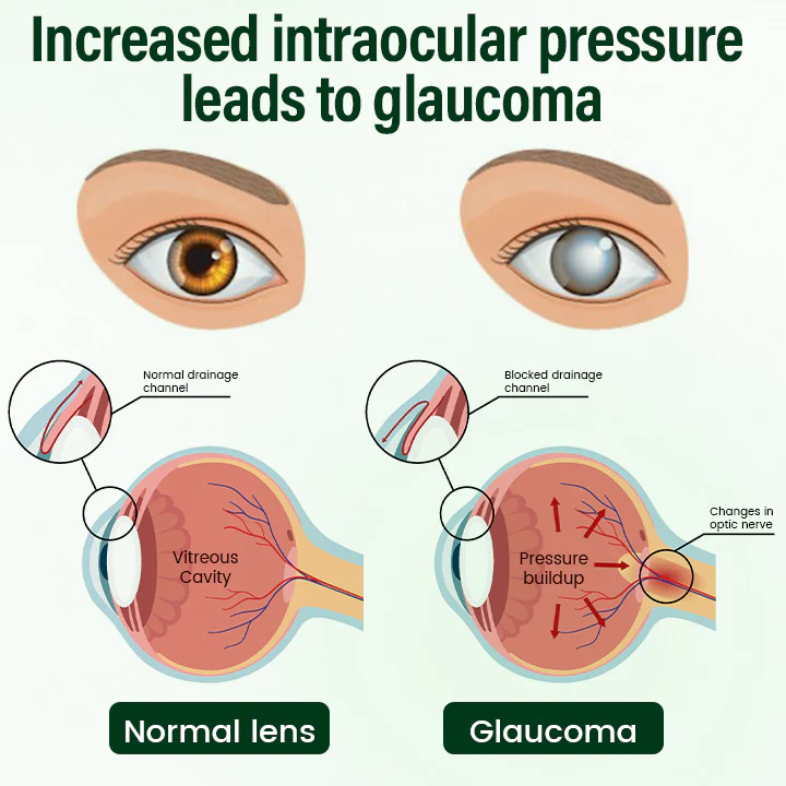 Timilk® VisionClear Nano Eye Drops image Timilk® VisionClear Nano Eye Drops