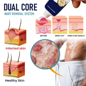 Cvreoz® Genital Warts Remover Cream image Cvreoz® Genital Warts Remover Cream