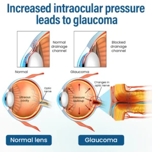 Timilk® VisionReborn Nano Eye Drops image Timilk® VisionReborn Nano Eye Drops