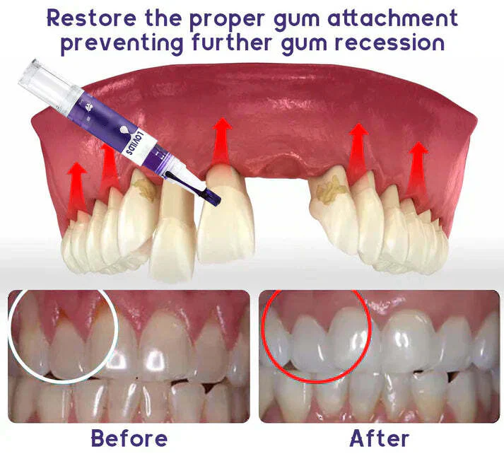 LOVILDS™ Gum Care Gel – Restore & Strengthen Your Gums image LOVILDS™ Gum Care Gel – Restore & Strengthen Your Gums