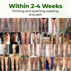 Timilk® Professional Leg Circulation Cream