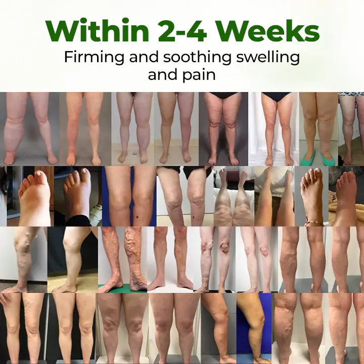 Timilk® Professional Leg Circulation Cream