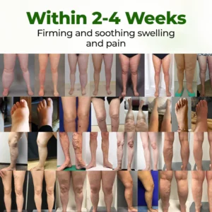 BBOJI® Professional Leg Circulation Cream image BBOJI® Professional Leg Circulation Cream