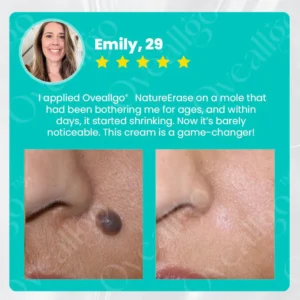 Oveallgo® NatureErase Instant Mole & Spot Cream