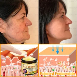 𝖠𝖯𝖪𝖠𝖯𝖪® 𝖡𝖾𝖾 𝗏𝖾𝗇𝗈𝗆 𝖲𝗄𝗂𝗇 𝖱𝖾𝗌𝗍𝗈𝗋𝖺𝗍𝗂𝗈𝗇 𝖢𝗋𝖾𝖺𝗆 image 𝖠𝖯𝖪𝖠𝖯𝖪® 𝖡𝖾𝖾 𝗏𝖾𝗇𝗈𝗆 𝖲𝗄𝗂𝗇 𝖱𝖾𝗌𝗍𝗈𝗋𝖺𝗍𝗂𝗈𝗇 𝖢𝗋𝖾𝖺𝗆