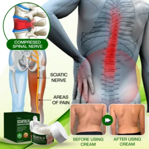Timilk® Sciatoliv Sciatica Relief Cream image Timilk® Sciatoliv Sciatica Relief Cream
