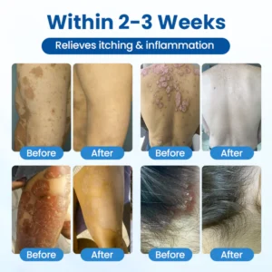 Timilk® Magnesium Herbal Treatment Spray image Timilk® Magnesium Herbal Treatment Spray