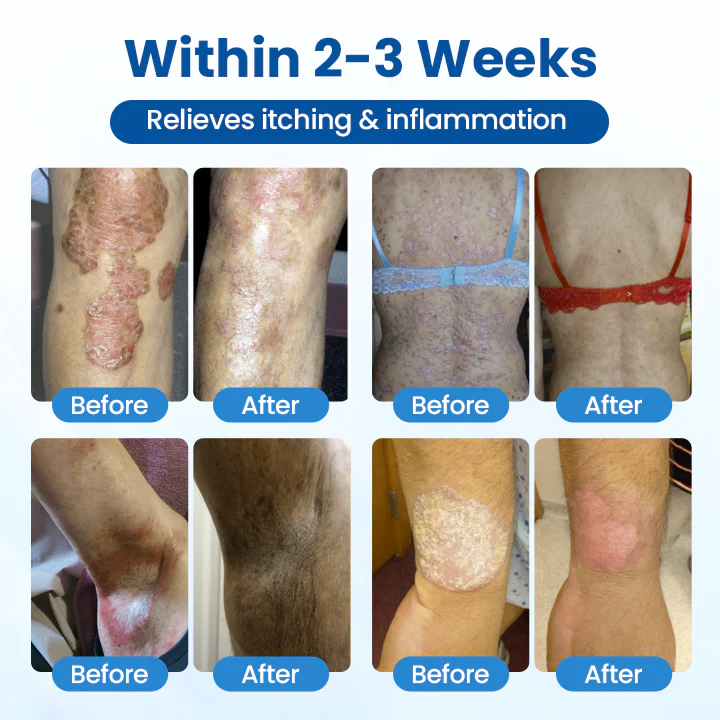 Timilk® Magnesium Herbal Treatment Spray image Timilk® Magnesium Herbal Treatment Spray