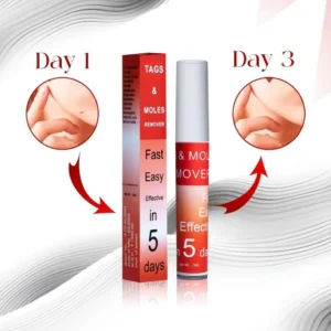 Fivfivgo™ WipeOff Tags & Mole Remover