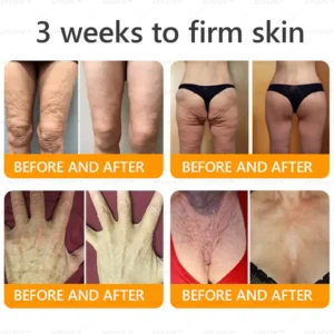 𝖠𝖯𝖪𝖠𝖯𝖪® 𝖡𝖾𝖾 𝗏𝖾𝗇𝗈𝗆 𝖲𝗄𝗂𝗇 𝖱𝖾𝗌𝗍𝗈𝗋𝖺𝗍𝗂𝗈𝗇 𝖢𝗋𝖾𝖺𝗆