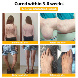 Zentheca BeeThera | Bee Venom-Infused Relief for Bones & Joints image Zentheca BeeThera | Bee Venom-Infused Relief for Bones & Joints