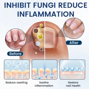 Timilk® PsoriCure Magnesium Herbal Spray image Timilk® PsoriCure Magnesium Herbal Spray