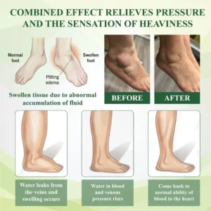 ATTDX® EdemaFree Flow Drain Massage Cream