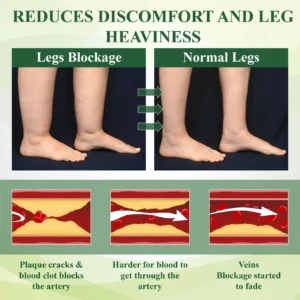 ATTDX® FluidEase Leg Therapy Edema Cream