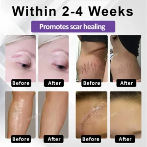 ATTDX® ClearScar Advanced Therapy Spray image ATTDX® ClearScar Advanced Therapy Spray