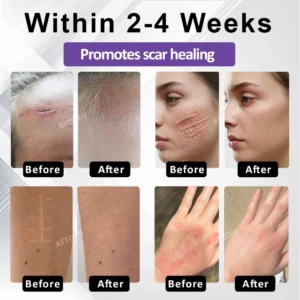 ATTDX® ClearScar Advanced Therapy Spray image ATTDX® ClearScar Advanced Therapy Spray