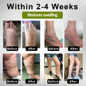 ATTDX® EdemaFree Flow Drain Massage Cream