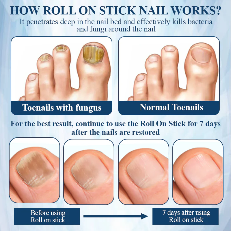 ATTDX® FungaGuard Botanica Roll On Stick image ATTDX® FungaGuard Botanica Roll On Stick