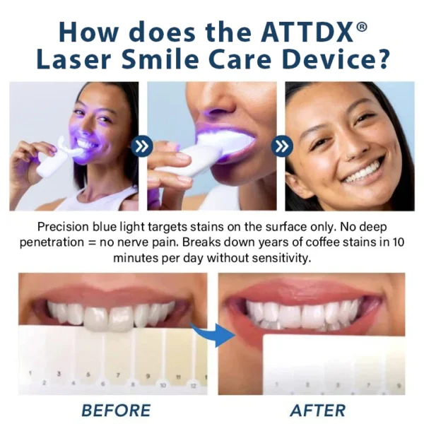 ATTDX® Laser Smile Care Device